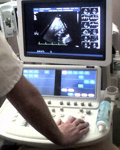 Ultrasound Device